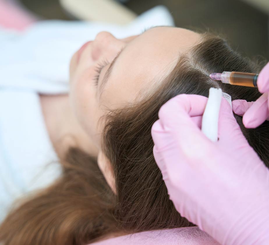 Mesoterapia-capilar-mostoles